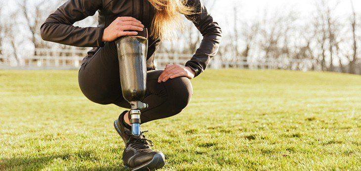 A woman in athlete gear with a prosthetic leg stretching ready for exercise